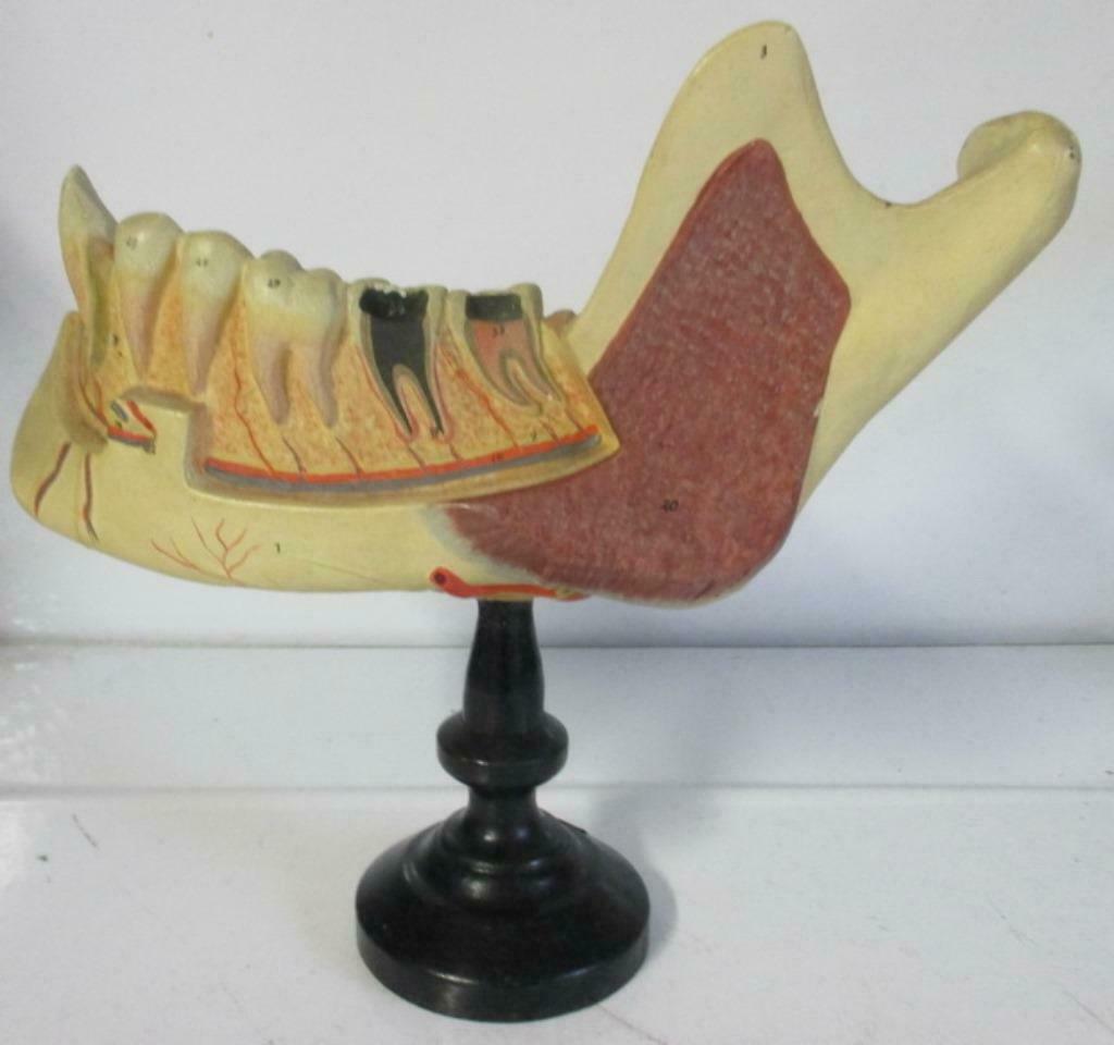antiek anatomisch model kaak met tanden gebit 4A, Verzenden