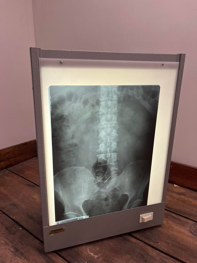 Negatoscoop, Audio, Tv en Foto, Optische apparatuur | Microscopen, Ophalen, Gebruikt