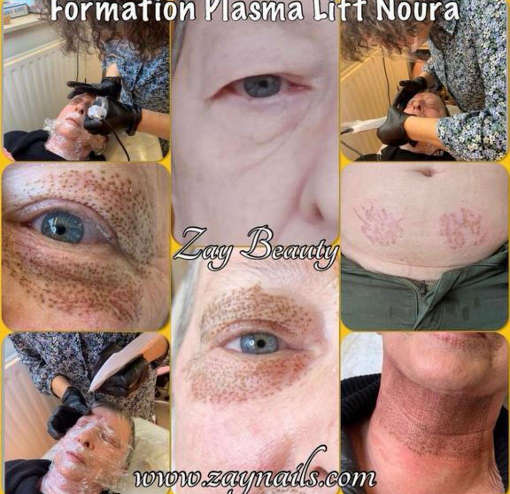 !!!Promo formation plasma Lift!!!