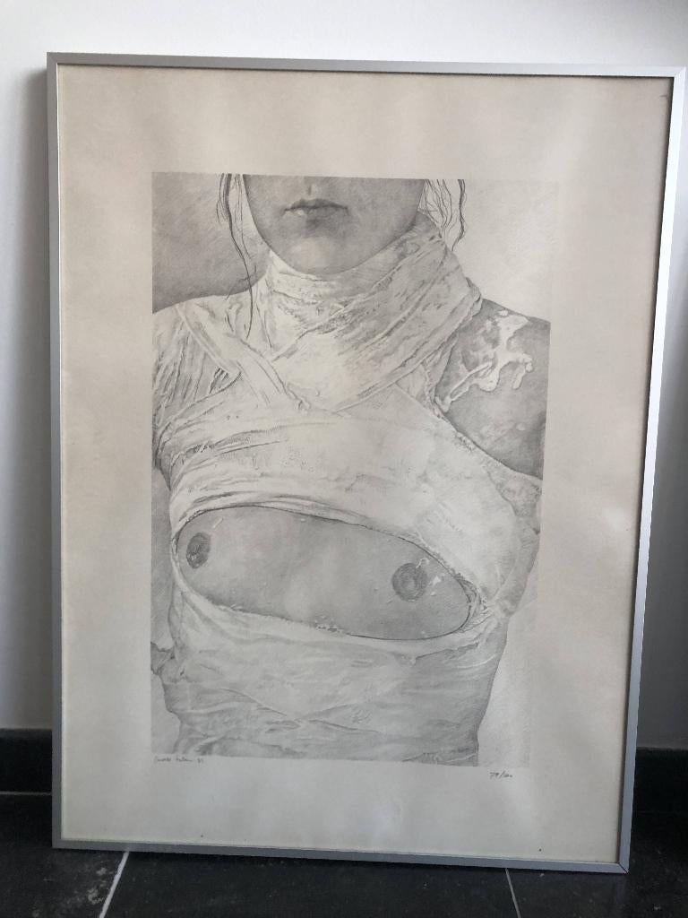 Litho Max Selen, Ophalen