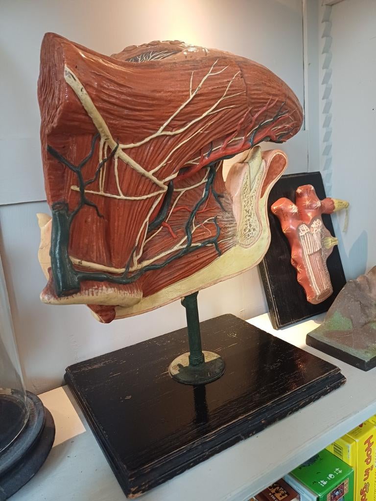 Anatomisch model De Tong, Ophalen