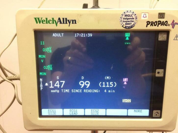Welch Allyn vital signs monitor met toebehoren in koffer, Niet ingevuld, Enlèvement ou Envoi, Niet ingevuld, Utilisé