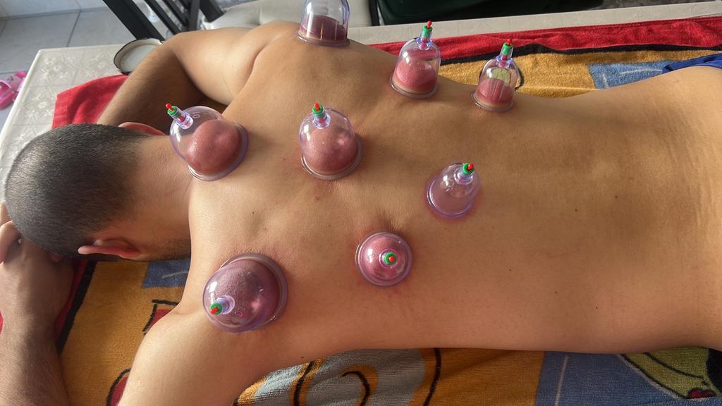 الحجامة النبوية, Services & Professionnels, Esthéticiennes | Manucure