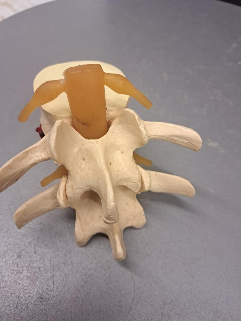 Lendenwervels Model Anatomisch Wervelkolom Lumbale Hernia An, Ophalen of Verzenden, Zo goed als nieuw
