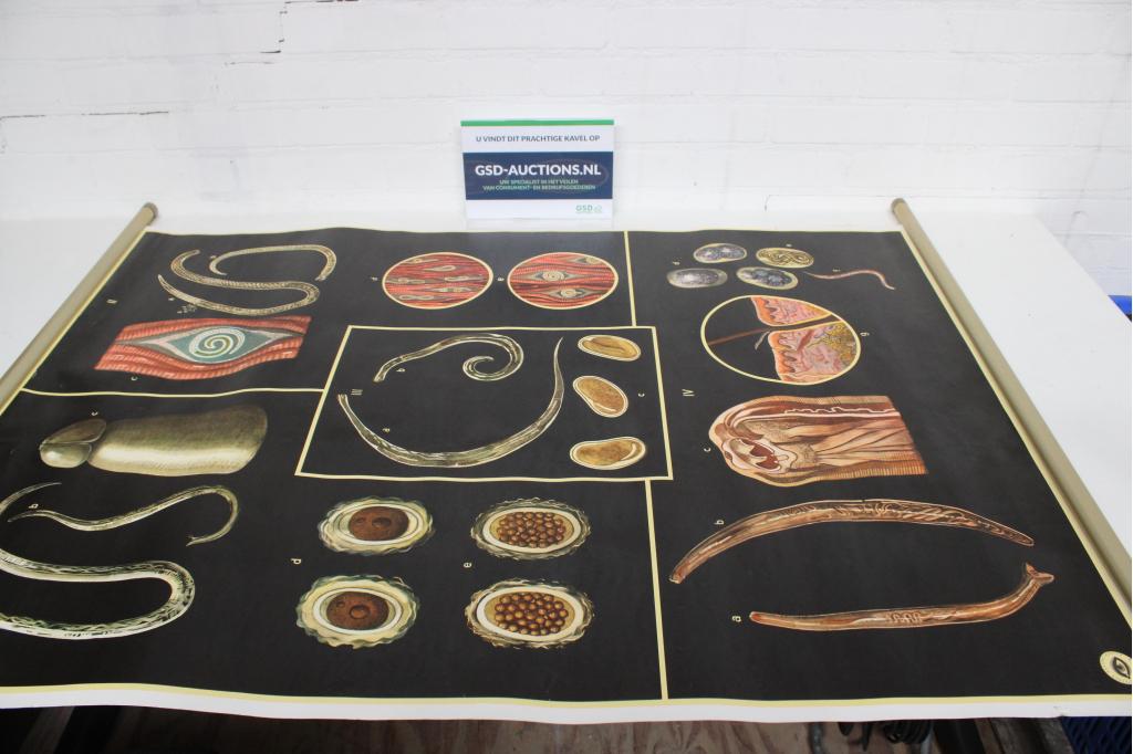 Vintage Anatomische Kaart over Darm Parasieten