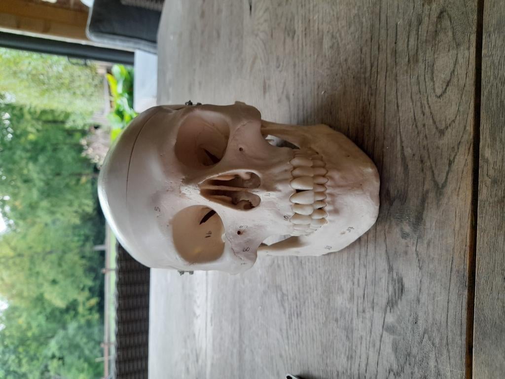 Anatomisch schedel, Diversen, Ophalen